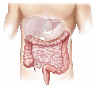Reliability of bowel cancer screening | Dr. Saurabh Mohite